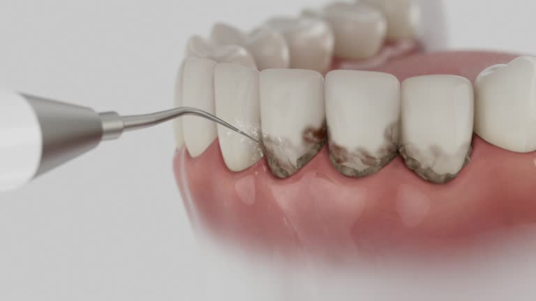 Trusted Tooth Extraction service in Lawton, MI - Dentist Open Now